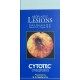 Neoplastic Lesions: Cytotec - Hardcover